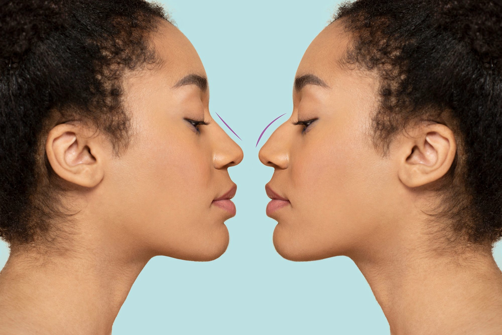 Article on the topic Top destinations for safe and affordable rhinoplasty