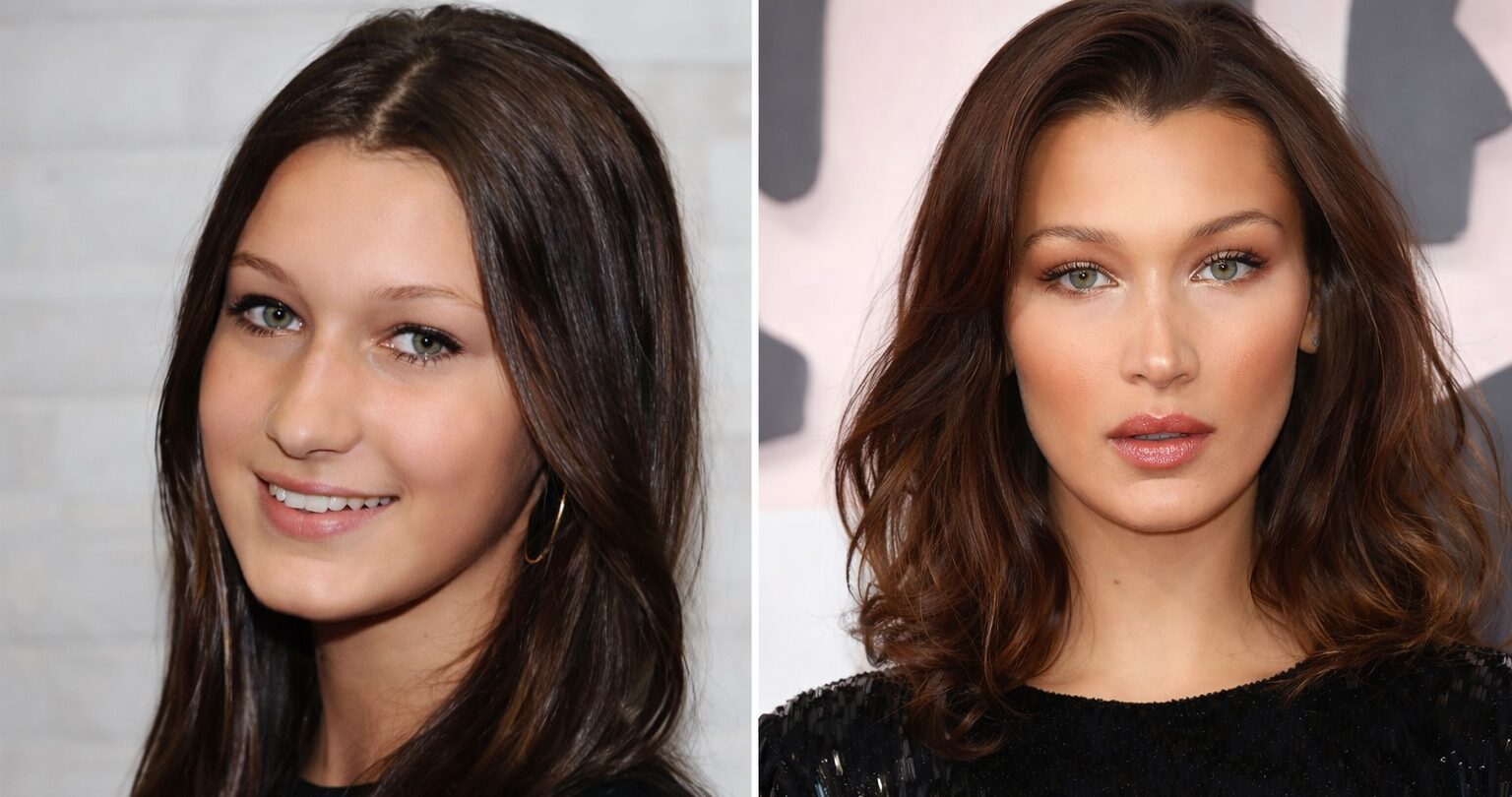 Article on the topic Bella Hadid Before Plastic Surgery